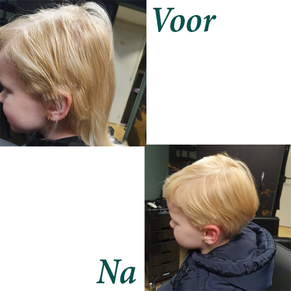 voor na 1